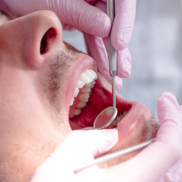 Oral Cancer Screening