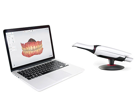 Intra-Oral Scanner